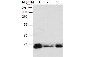 Western Blot analysis of 293T cell and Mouse brain tissue, A549, Hela, A172 and HT-29 cell using RAB6A Polyclonal Antibody at dilution of 1:650 (RAB6A anticorps)