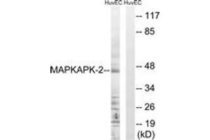 Western blot analysis of extracts from HuvEc cells, treated with Adriamycin 0. (MAPKAP Kinase 2 anticorps  (AA 188-237))