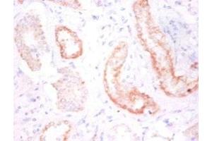 Immunohistochemistry of paraffin-embedded human kidney tissue using ABIN7146207 at dilution of 1:50 (Cadherin 12 anticorps  (AA 56-605))