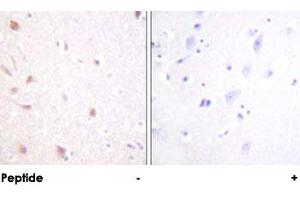 Immunohistochemical analysis of paraffin-embedded human brain tissue using MKI67IP polyclonal antibody . (NIFK anticorps)