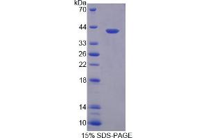 Image no. 1 for Myosin Binding Protein C, Slow Type (MYBPC1) (AA 1-277) protein (His tag) (ABIN6237427)