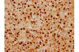 IHC image of ABIN7127830 diluted at 1:92.