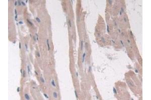 Detection of ADIPOR2 in Rat Heart Tissue using Polyclonal Antibody to Adiponectin Receptor 2 (ADIPOR2)