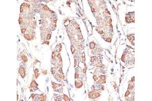 Immunohistochemistry of paraffin-embedded Human stomach using ATP5A1 Polyclonal Antibody at dilution of 1:100 (40x lens).