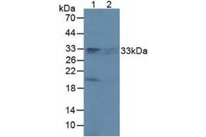 Western blot analysis of (1) Rat Brain Tissue and (2) Rat Lung Tissue. (Peroxiredoxin 4 anticorps  (AA 6-249))
