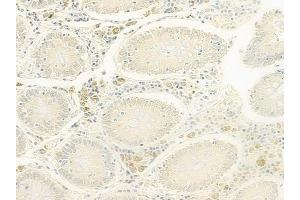 ABIN6266036 and ABIN6277779 at 1/100 staining human normal colon tissue by IHC-P.