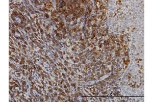 Immunoperoxidase of monoclonal antibody to ATP2A3 on formalin-fixed paraffin-embedded human tonsil.