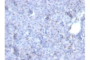 Formalin-fixed, paraffin-embedded human Pancreas stained with AKT1 Mouse Monoclonal Antibody (AKT1/2784). (AKT1 anticorps  (AA 85-189))