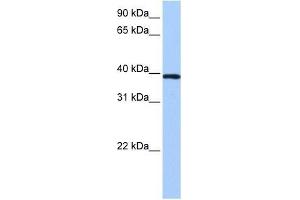 ZNF618 antibody used at 0. (ZNF618 anticorps  (N-Term))