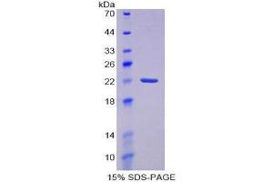 SDS-PAGE (SDS) image for Prostaglandin D2 Synthase (PTGDS) (AA 32-190) protein (His tag) (ABIN2126444) (PTGDS Protein (AA 32-190) (His tag))