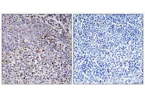 Immunohistochemistry (IHC) image for anti-Holocytochrome C Synthase (HCCS) (Internal Region) antibody (ABIN1850244) (HCCS anticorps  (Internal Region))