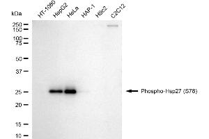 Western blotting analysis using phospho-Hsp27 (S78) antibody (ABIN7798843).