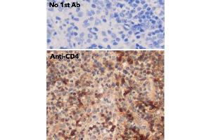 IHC of human appendix using anti-CD4 antibody and FFPE tissue after heat-induced antigen retrieval.