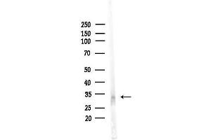 Western blot analysis of lysates from PC12 cells(UV,30 min treatment), using C Antibody at 1/1000 dilution.