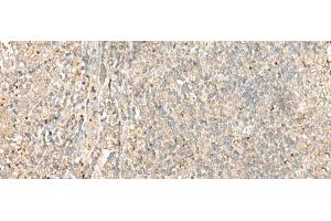 anti-Eukaryotic Translation Initiation Factor 2-alpha Kinase 1 (EIF2AK1) antibody