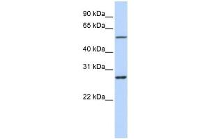 Western Blotting (WB) image for anti-Ring Finger Protein 217 (RNF217) antibody (ABIN2458748) (RNF217 anticorps)