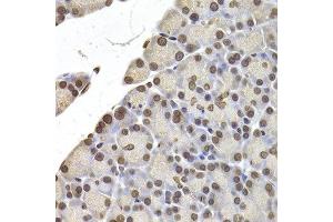 Immunohistochemistry of paraffin-embedded rat pancreas using LMNB2 antibody at dilution of 1:200 (400x lens). (Lamin B2 anticorps)