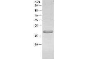 Western Blotting (WB) image for Calcium Modulating Ligand (CAMLG) (AA 1-189) protein (His tag) (ABIN7122088)