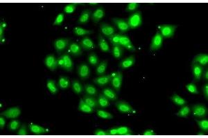 Immunofluorescence analysis of U2OS cells using PIAS3 Polyclonal Antibody (PIAS3 anticorps)