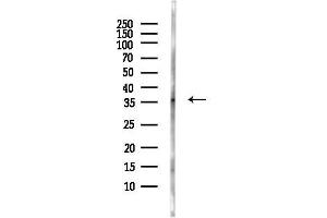 anti-Poly (ADP-Ribose) Polymerase Family, Member 16 (PARP16) antibody