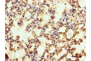 Immunohistochemistry of paraffin-embedded human lung tissue using ABIN7174683 at dilution of 1:100 (MFSD11 anticorps  (AA 191-238))