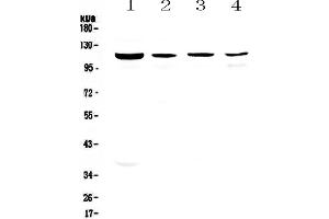 Western blot analysis of RPGR using anti-RPGR antibody .