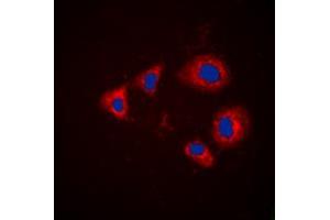 Immunofluorescent analysis of Aurora A (pT288) staining in HEK293T cells. (Aurora A anticorps  (pSer288))