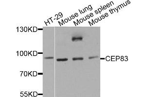Western blot analysis of extracts of various cell lines, using CEP83 antibody. (CCDC41 anticorps)