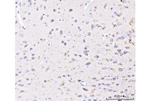 IHC analysis of PLD3 using anti-PLD3 antibody (ABIN7599439). (PLD3 anticorps  (AA 1-490))