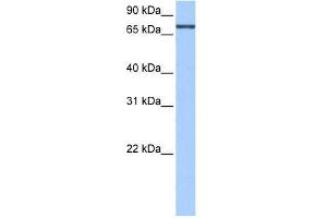 Human Liver; WB Suggested Anti-AGXT2L2 Antibody Titration: 0. (AGXT2L2 anticorps  (N-Term))