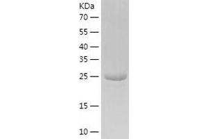 Western Blotting (WB) image for Nicotinamide Nucleotide Adenylyltransferase 3 (NMNAT3) (AA 1-252) protein (His-IF2DI Tag) (ABIN7124174)