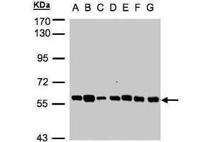 WB Image Sample(30 ug whole cell lysate) A: 293T B: A431 , C: H1299 D: HeLa S3 , E: Hep G2 , F: MOLT4 , G: Raji , 7. (TULP1 anticorps)