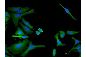Immunofluorescence of monoclonal antibody to ITGA1 on HeLa cell.