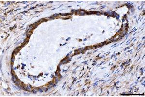 IHC analysis of GIGYF2 using anti-GIGYF2 antibody (ABIN7601679). (GIGYF2 anticorps  (AA 413-1299))