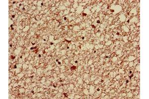 Immunohistochemistry of paraffin-embedded human brain tissue using ABIN7143166 at dilution of 1:100