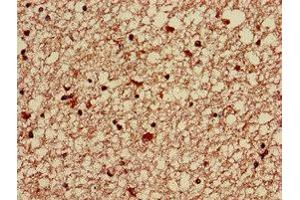 Immunohistochemistry of paraffin-embedded human brain tissue using ABIN7143166 at dilution of 1:100 (Activator of Basal Transcription 1 anticorps  (AA 197-270))