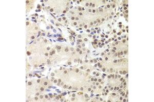 Immunohistochemistry of paraffin-embedded human stomach using PRPF3 Antibody (ABIN5973192) at dilution of 1/100 (40x lens). (PRPF3 anticorps)