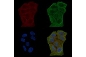 ABIN6255406 and ABIN6267612 staining Hela cells(30 min of UV treatment) by IF/ICC.