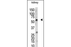 Antibody is used in Western blot to detect UBCE7IP3 in mouse kidney tissue lysate. (RBCK1 anticorps  (N-Term))