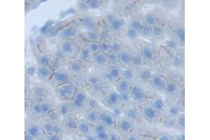 Figure. (Angiotensin II Type-1 Receptor anticorps  (AA 263-359))