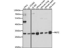Western blot analysis of extracts of various cell lines, using MLF2 antibody (ABIN7268725) at 1:1000 dilution. (MLF2 anticorps  (AA 1-65))