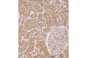 Immunohistochemical analysis of C on paraffin-embedded Human kidney tissue.