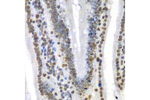 Immunohistochemistry of paraffin-embedded mouse Intestine using SEPT7 antibody (ABIN5974146) at dilution of 1/100 (40x lens). (Septin 7 anticorps)
