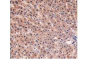 Detection of MMP12 in Rat Liver Tissue using Polyclonal Antibody to Matrix Metalloproteinase 12 (MMP12)