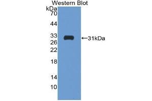 Western blot analysis of the recombinant protein. (Follistatin anticorps  (AA 35-283))