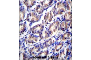 anti-Outer Dense Fiber of Sperm Tails 2-Like (ODF2L) (AA 543-572), (C-Term) antibody