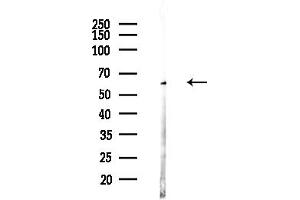 anti-Cysteine-S-conjugate beta-Lyase (CCBL1) (Internal Region) antibody