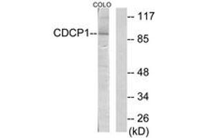 Western blot analysis of extracts from COLO205 cells, using CDCP1 Antibody. (CDCP1 anticorps  (AA 691-740))