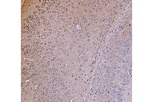 IHC analysis of PI 3 Kinase p85 alpha/PIK3R1 using anti-PI 3 Kinase p85 alpha/PIK3R1 antibody (ABIN7599781). (PIK3R1 anticorps  (AA 117-153))