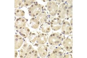 Immunohistochemistry of paraffin-embedded Human gastric using POU2F1 antibody at dilution of 1:100 (x400 lens). (POU2F1 anticorps)